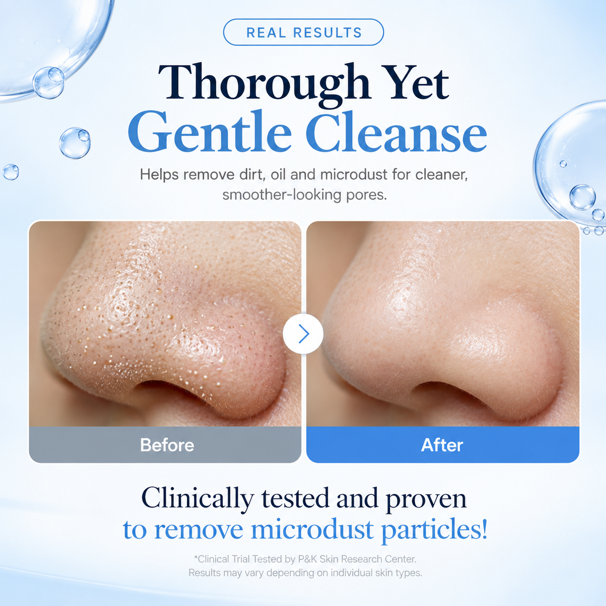 Skin Renewal Duo - Medicube